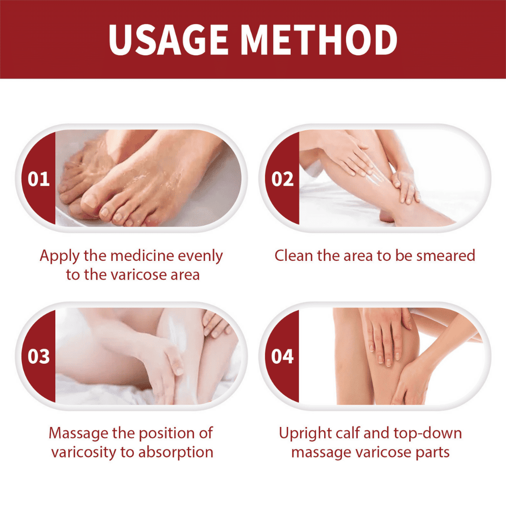 Varicose veins crema para varices - ESDealmania