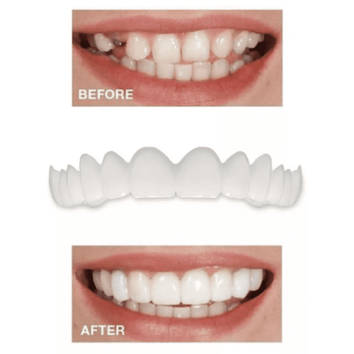 CARILLAS DE DIENTES POSTIZOS DE SONRISA - ESDealmania