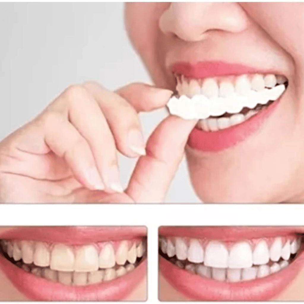 CARILLAS DE DIENTES POSTIZOS DE SONRISA - ESDealmania